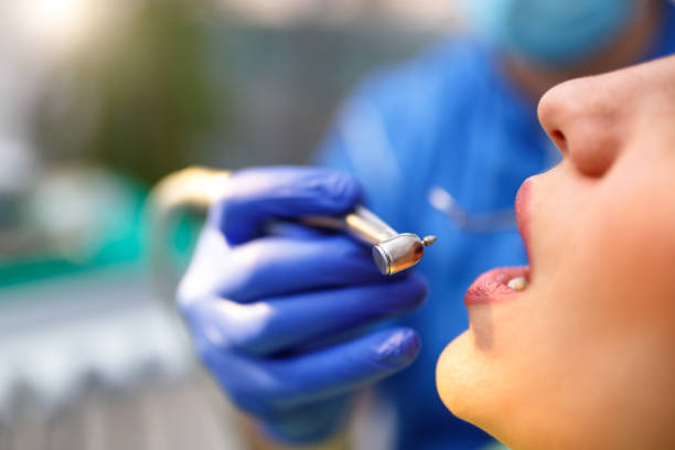 Best Wisdom Tooth Removal  in Estero, FL